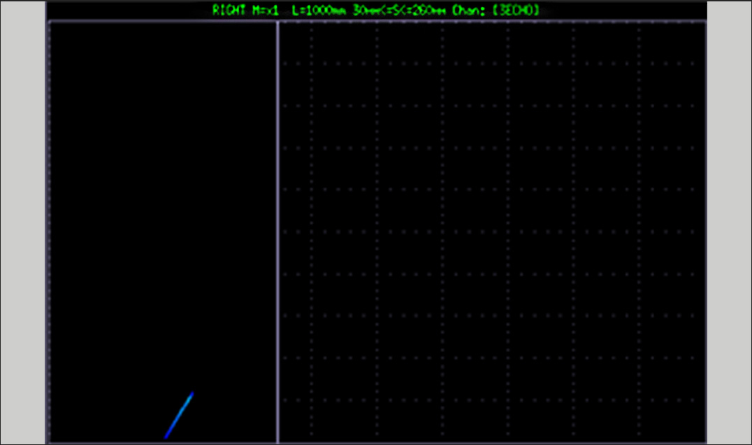 Ultrasonic B-scan showing corrosion-related metal loss