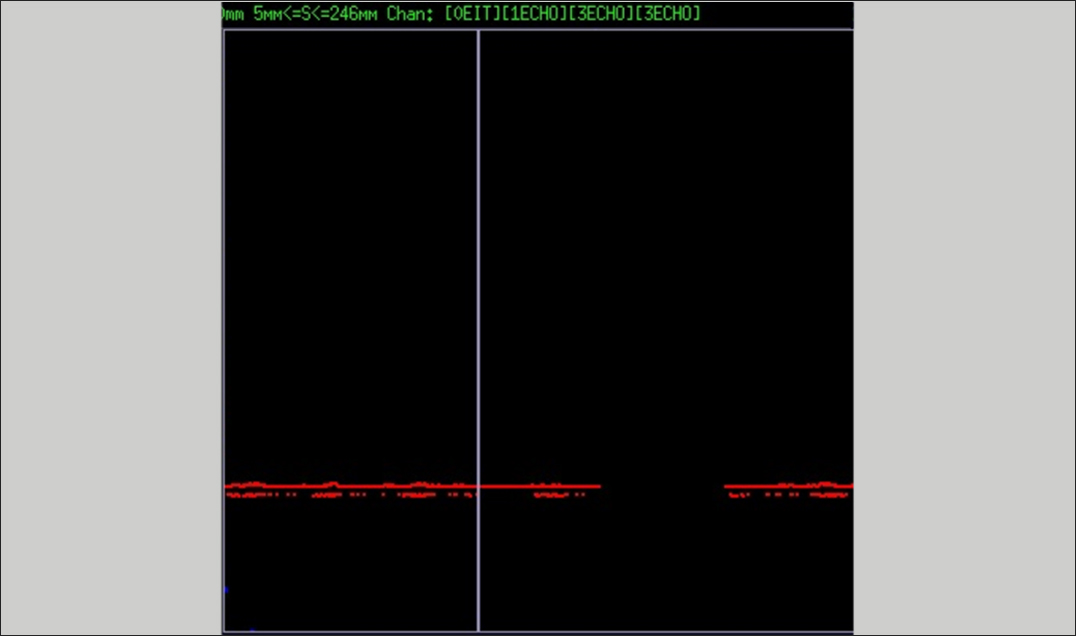 Ultrasonic B-scan display with reduced backwall signal from vertical crack