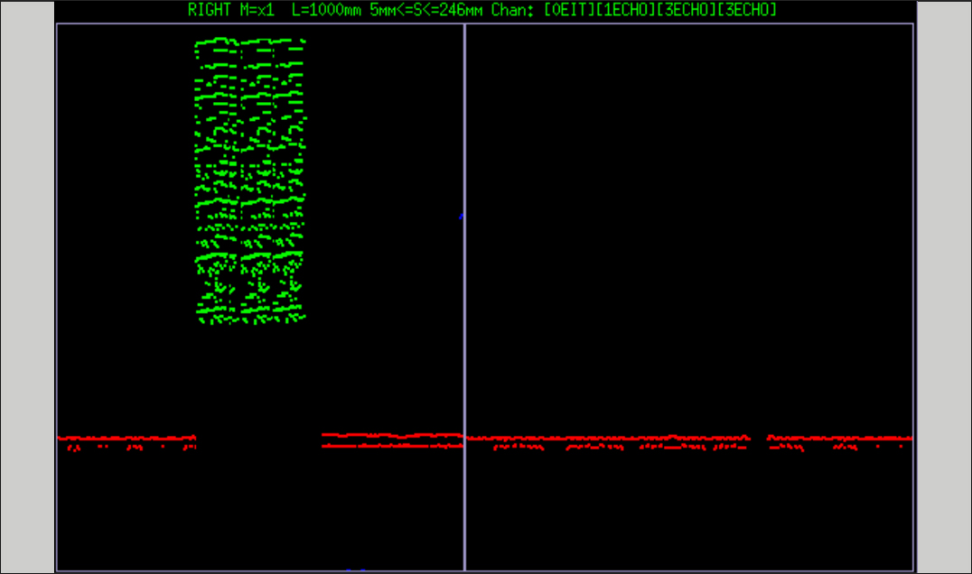 Ultrasonic B-scan showing shelling-related internal defects